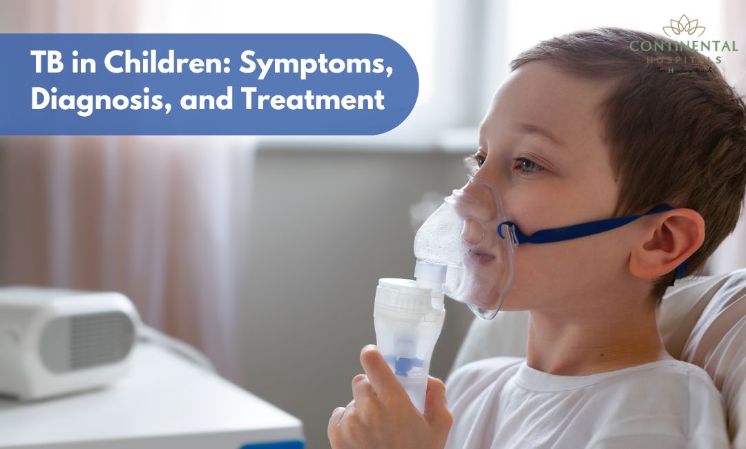 TB in Children: Symptoms, Diagnosis, and Treatment