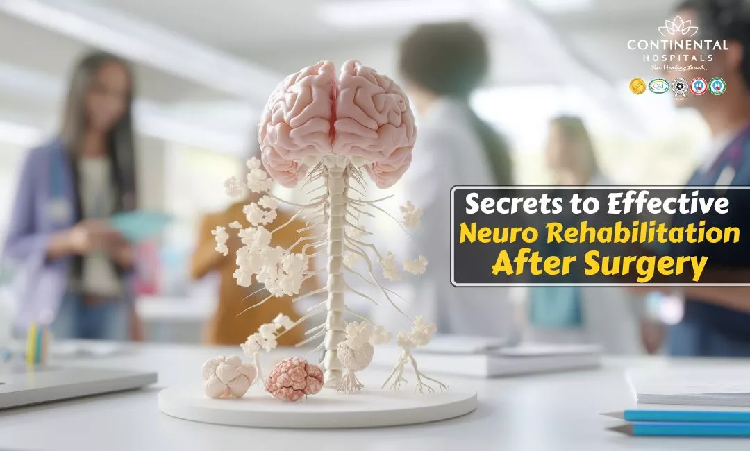 Secrets to Effective Neuro Rehabilitation After Surgery