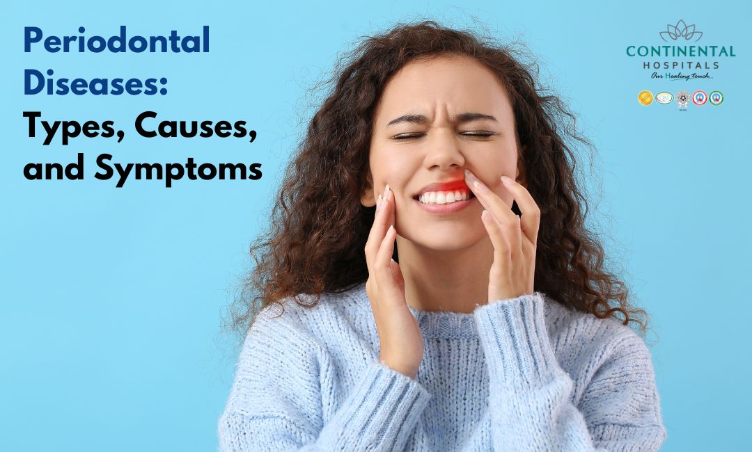 Periodontal Diseases: Types, Causes, and Symptoms