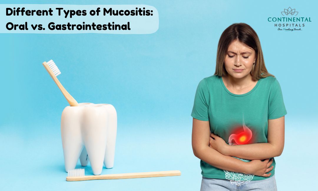 Different Types of Mucositis: Oral vs. Gastrointestinal