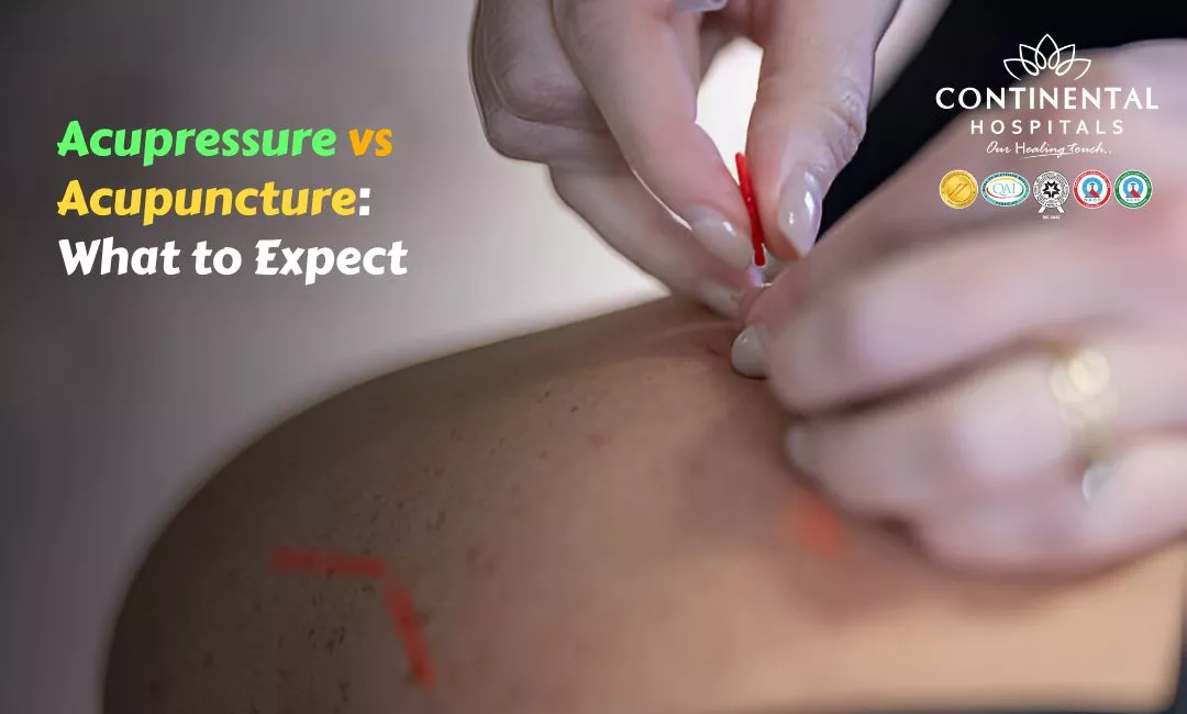 Acupressure vs Acupuncture: What to Expect