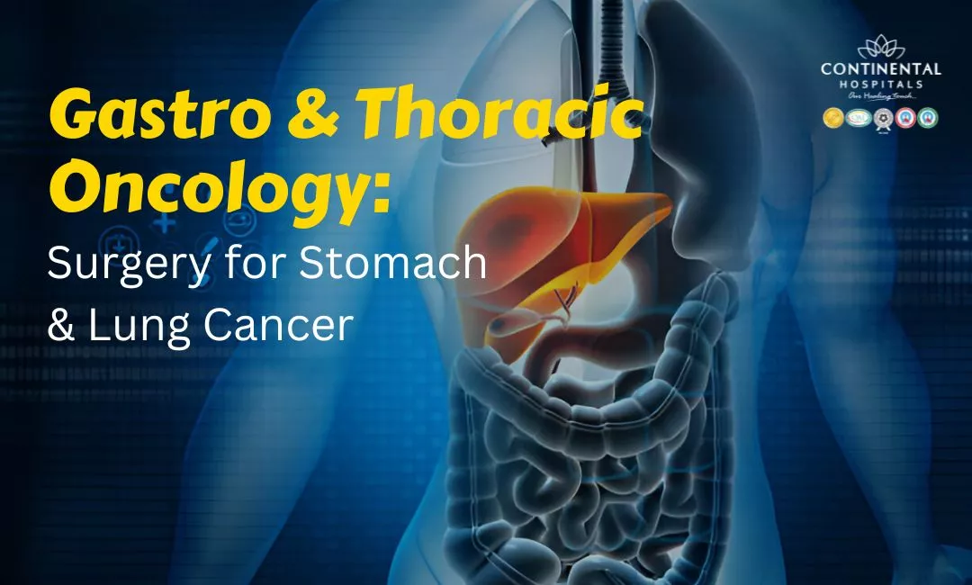 Gastro & Thoracic Oncology: Surgery for Stomach & Lung Cancer