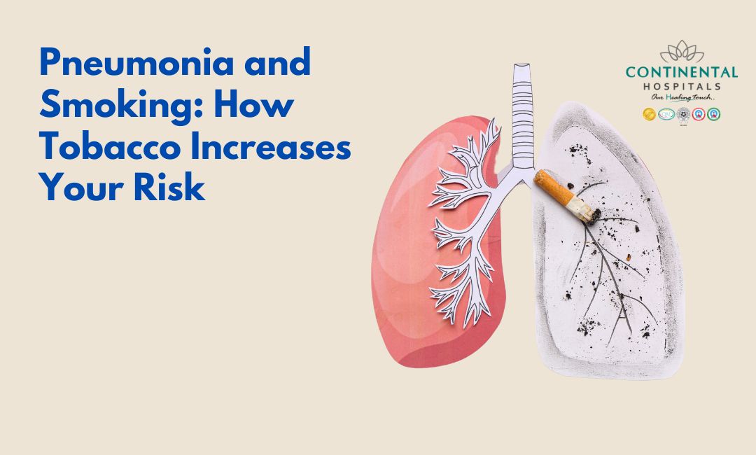 Pneumonia and Smoking: How Tobacco Increases Your Risk