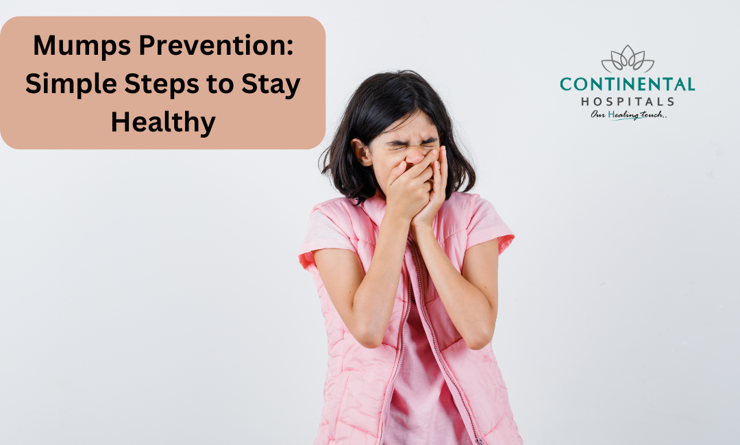 Mumps Prevention: Simple Steps to Stay Healthy