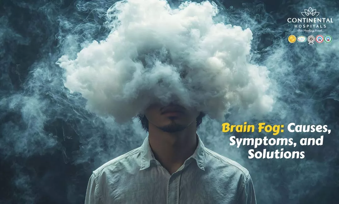 Brain Fog: Causes, Symptoms, and Solutions