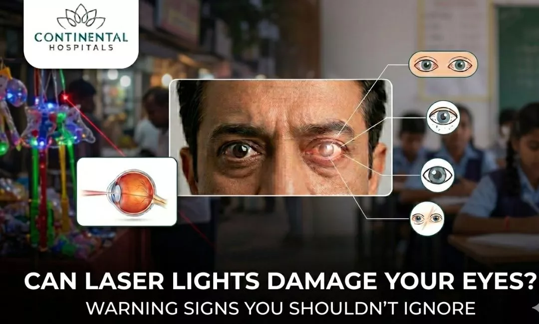 Can Laser Lights Damage Your Eyes? Warning Signs You Shouldn’t Ignore