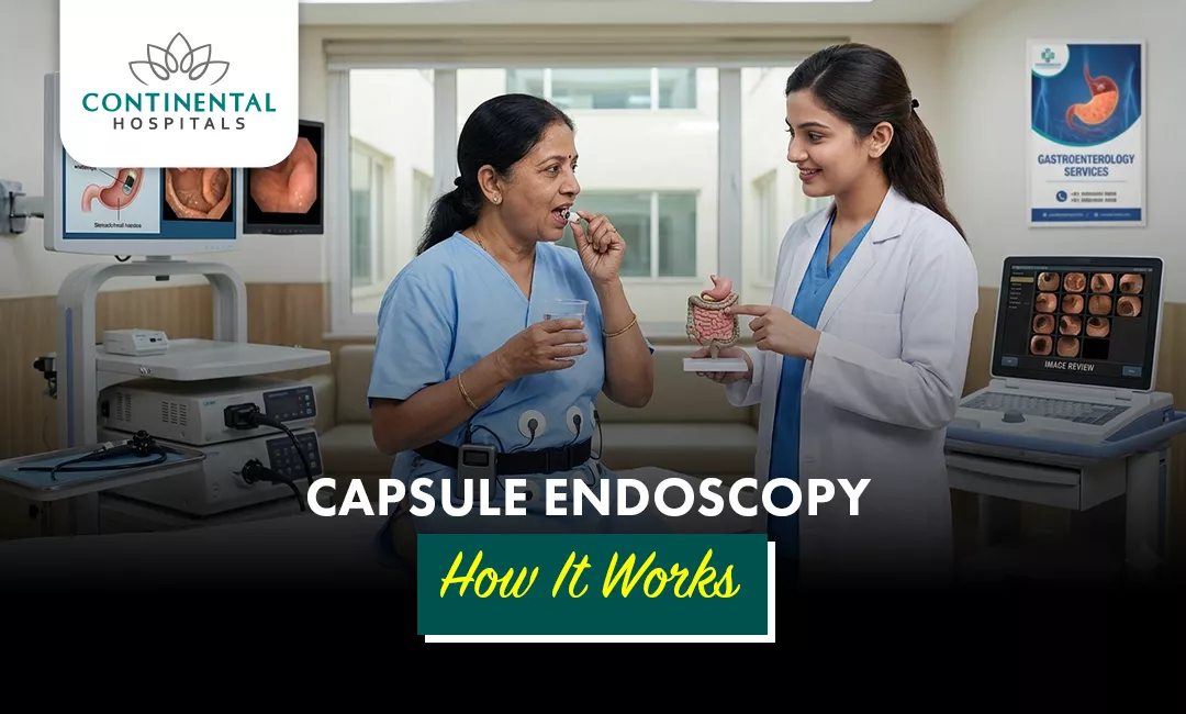 Capsule Endoscopy: How It Works