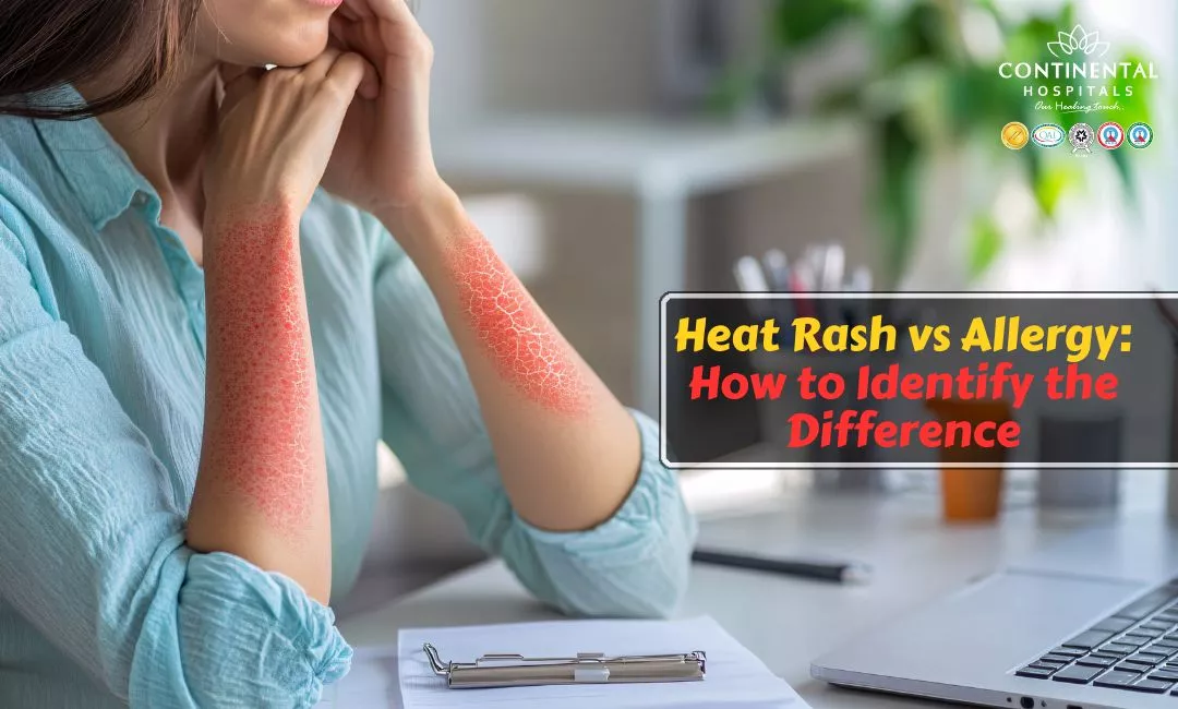 Heat Rash vs Allergy: How to Identify the Difference