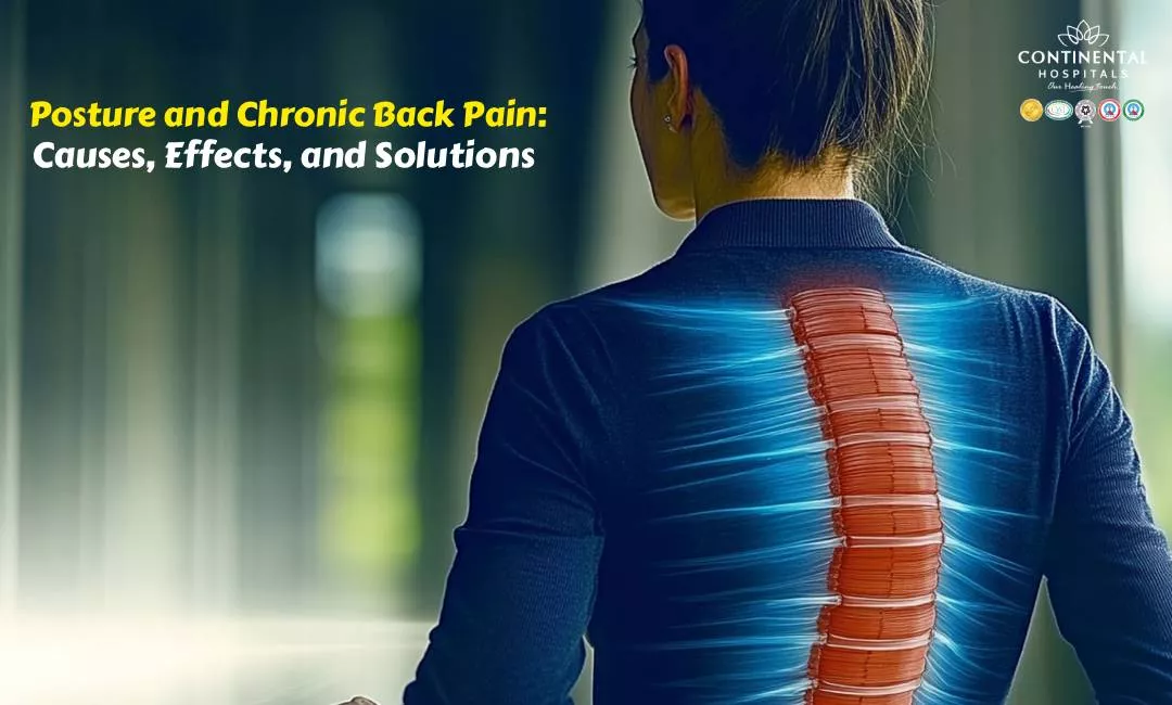 Posture and Chronic Back Pain: Causes, Effects, and Solutions