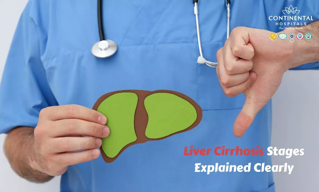 Cirrhosis of the Liver: Stages, Symptoms, Causes and Treatment Guide