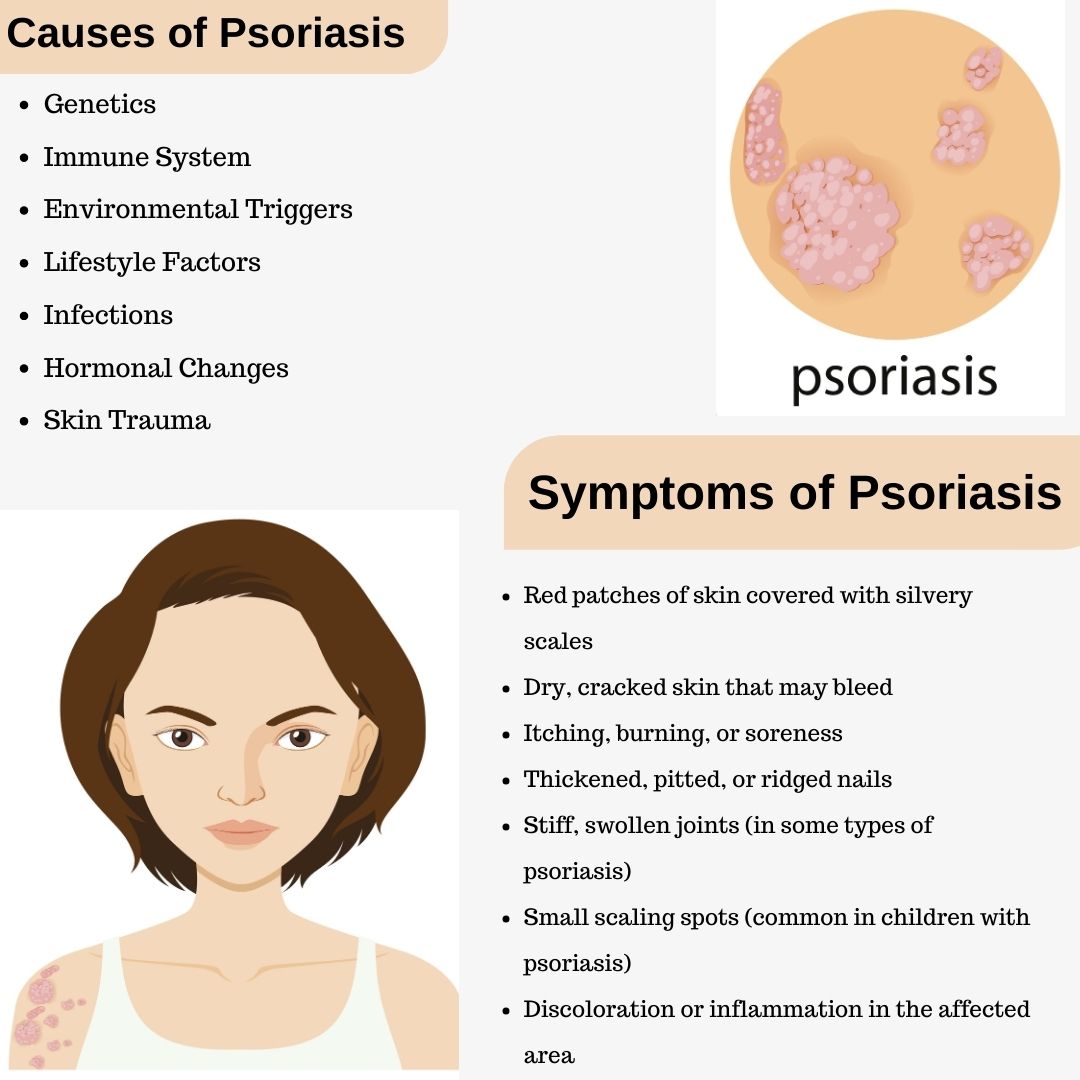 Symptoms of Psoriasis