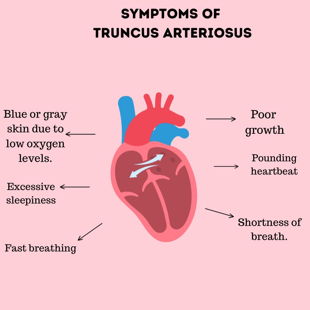 Symptoms of  Truncus arteriosus
