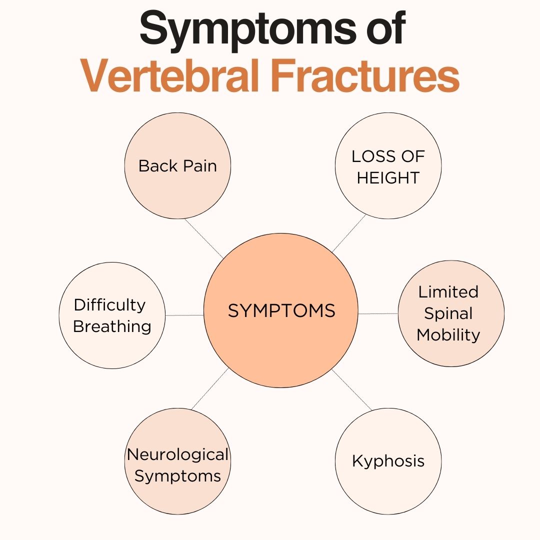 Symptoms of Vertebral Fractures