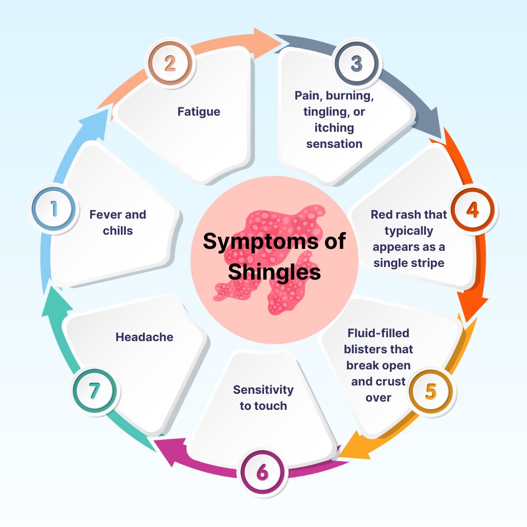 Symptoms of Shingles