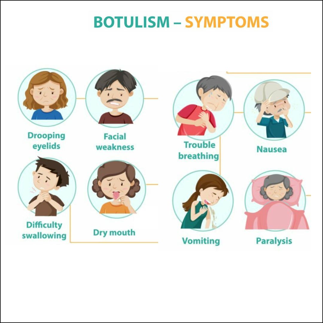 Botulism Causes Risk Factors Symptoms Treatment Botulism Causes Risk Factors Symptoms Treatment