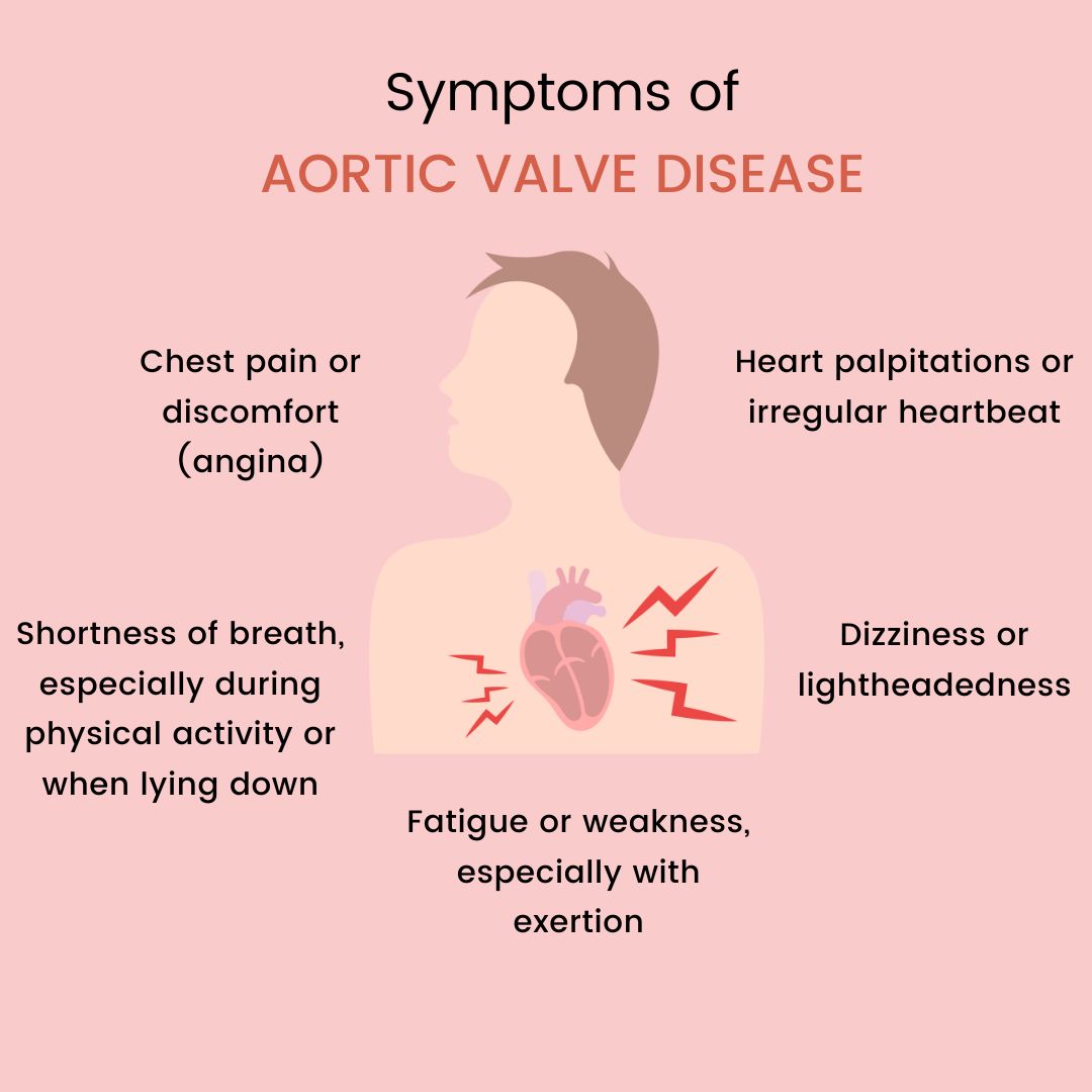 Symptoms of Aortic Valve Disease