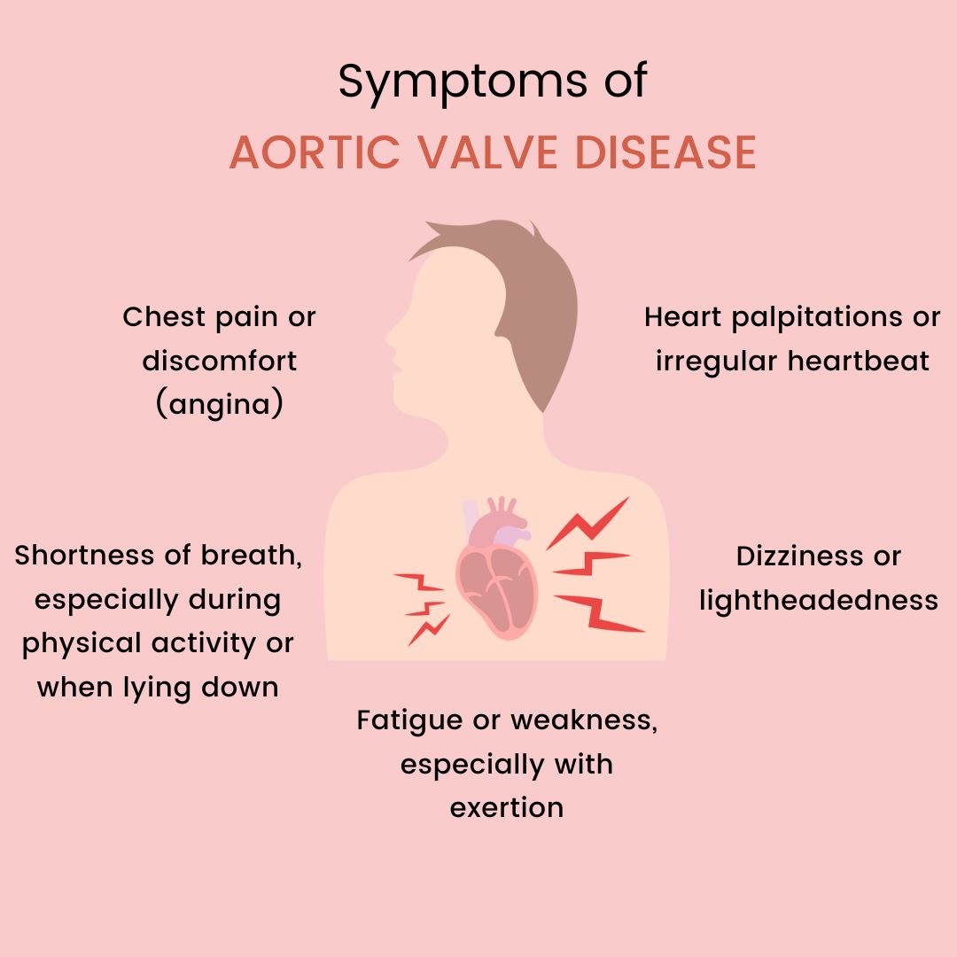 Heart Valve Disease Explained Types Symptoms VFIGOM