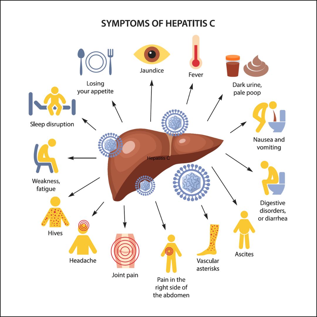 Symptoms of Hepatitis c