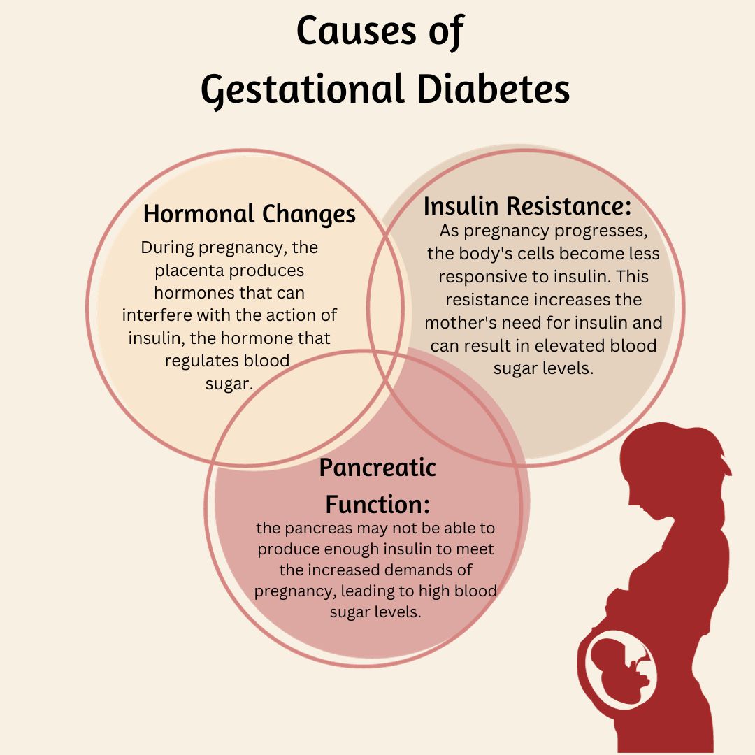 Causes of Gestational Diabetes
