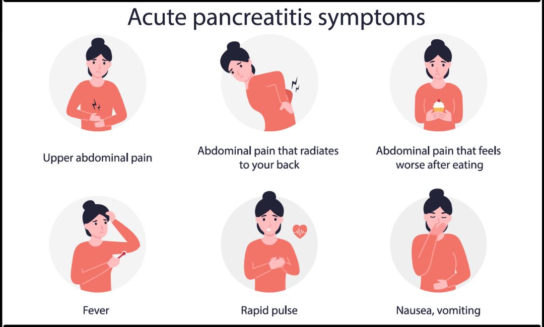 Pancreatitis symptoms