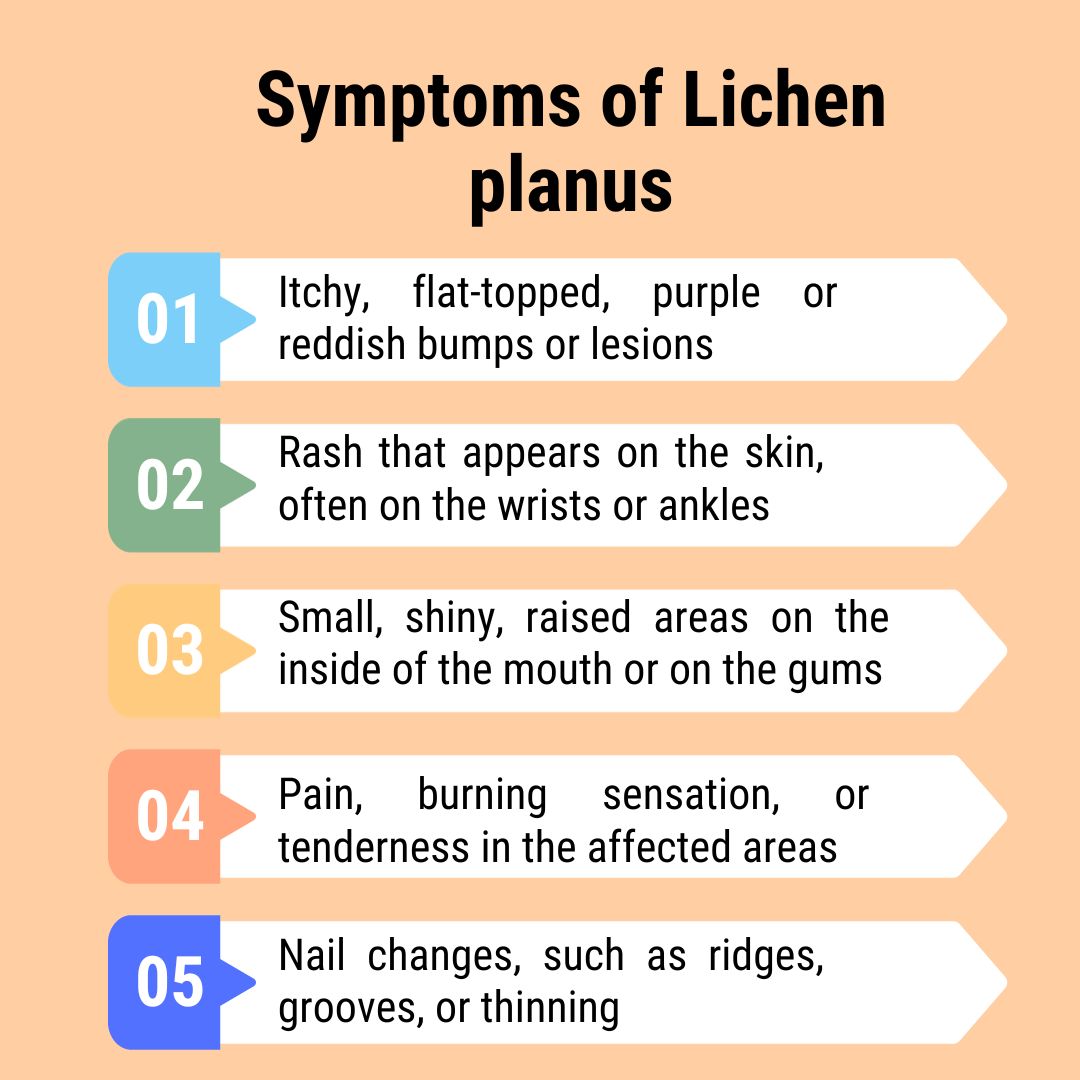 Symptoms of Lichen planus