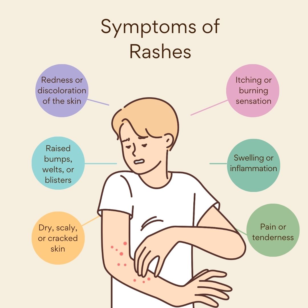 Symptoms of Rashes