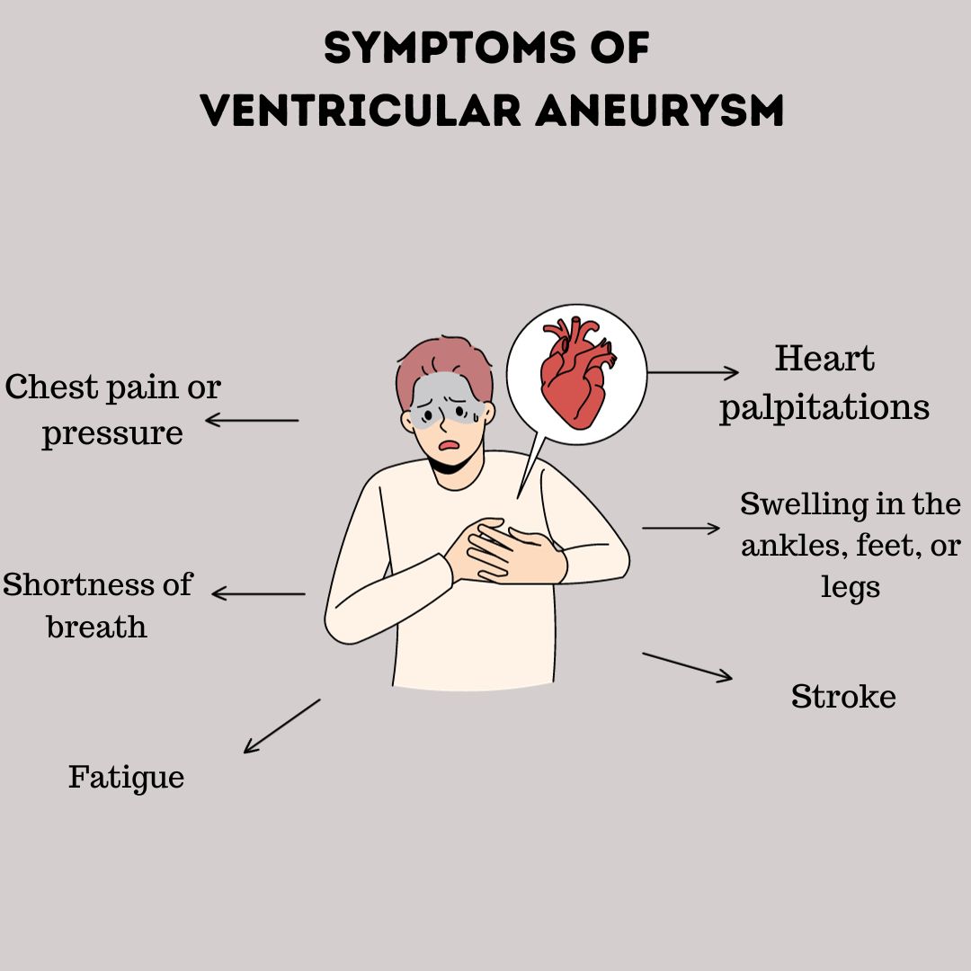 Ventricular Aneurysm