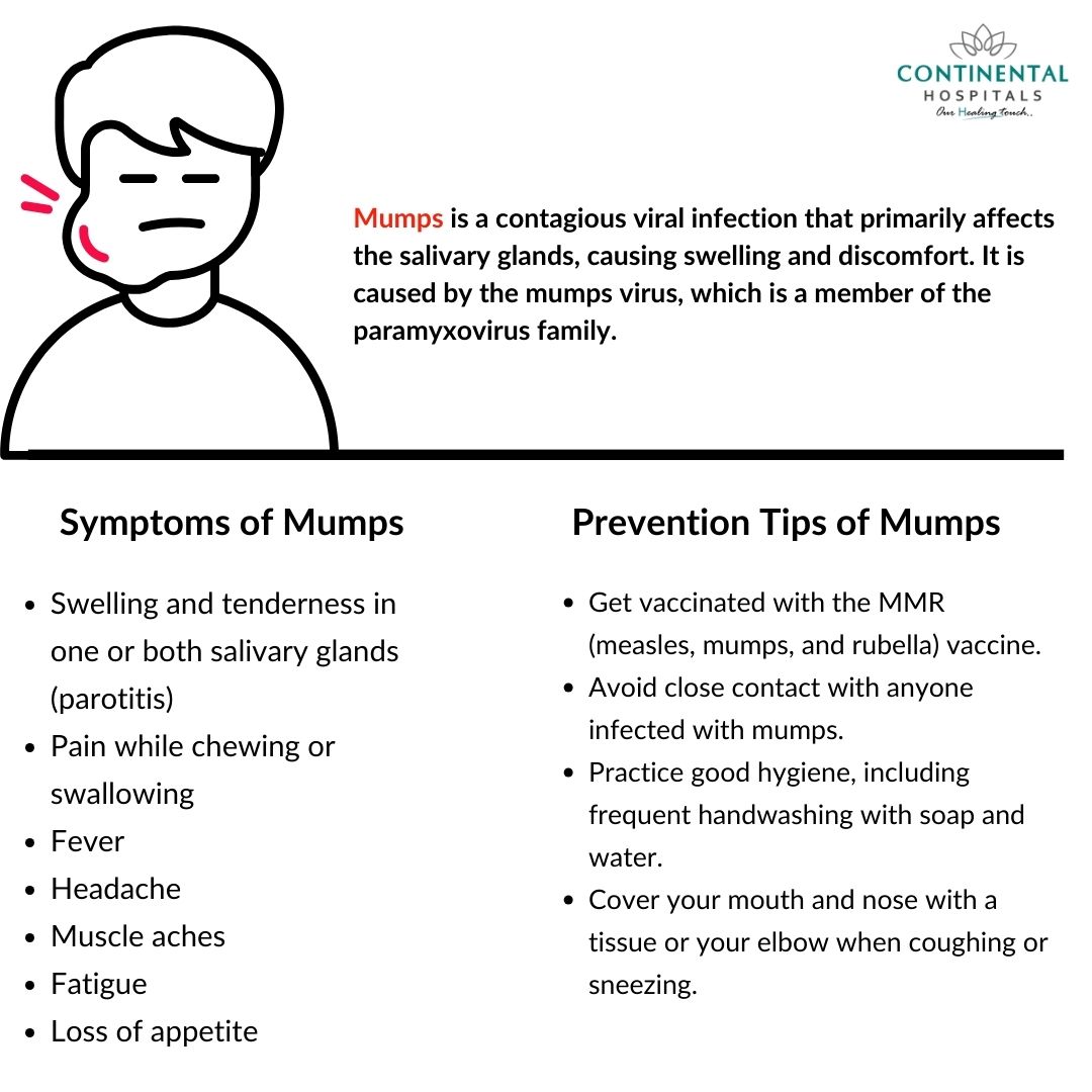 Mumps: Symptoms and Preventions