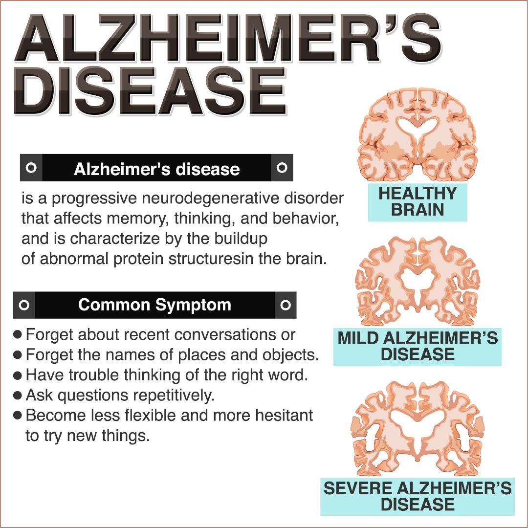 Early Signs of Alzheimer's: