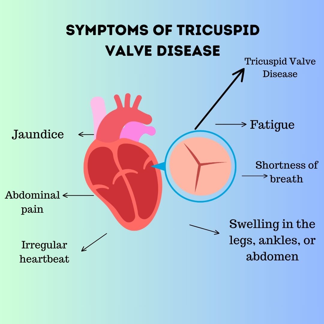 Symptoms of Tricuspid Valve Disease