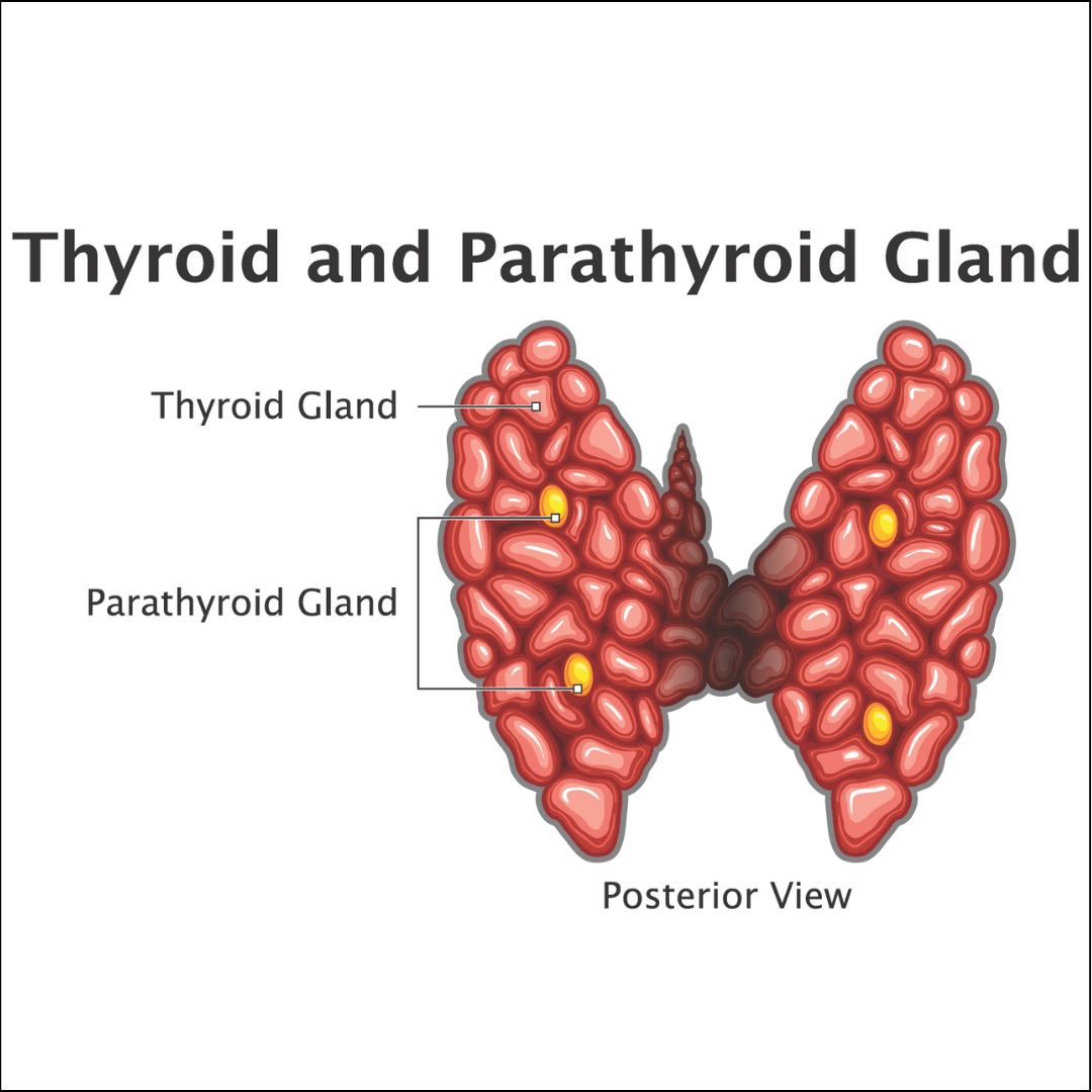 Parathyroid cancer 