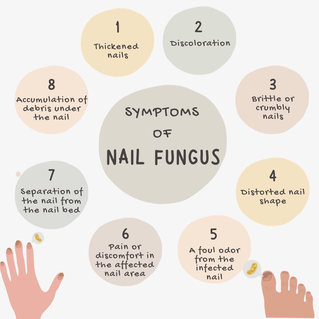 Symptoms of Nail Fungus