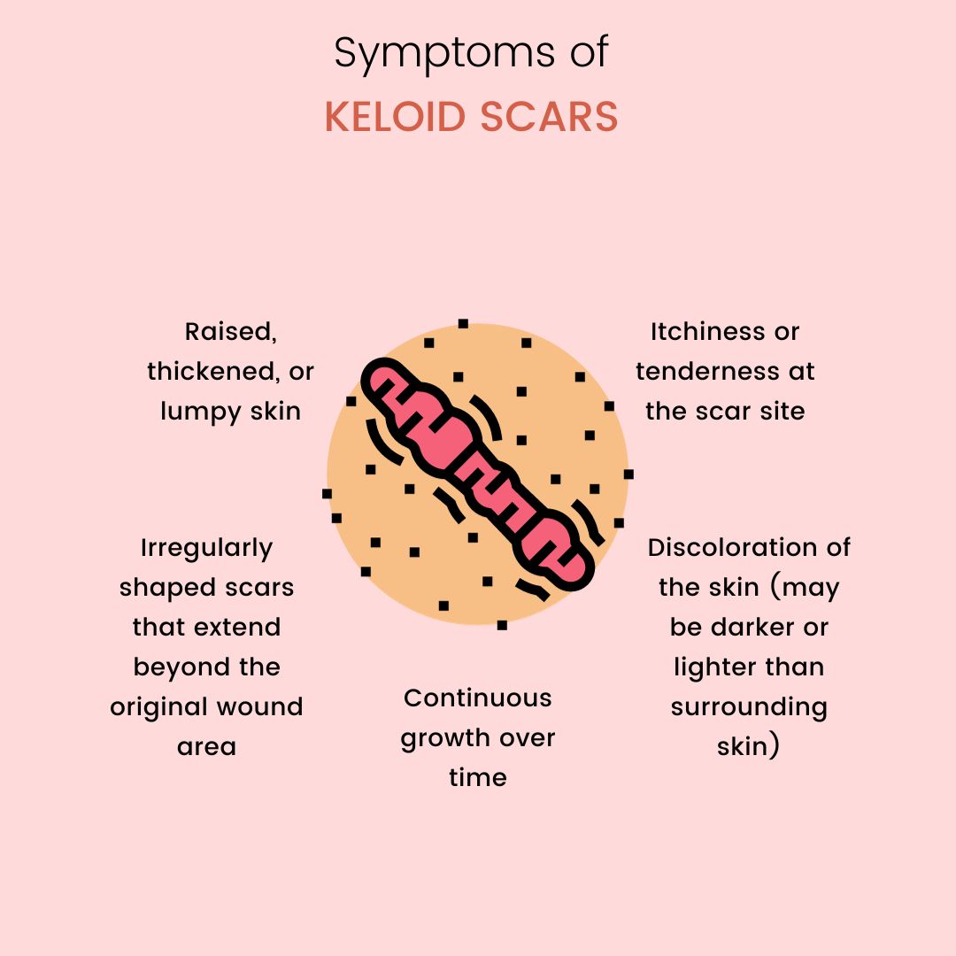 Symptoms of Keloid scars 