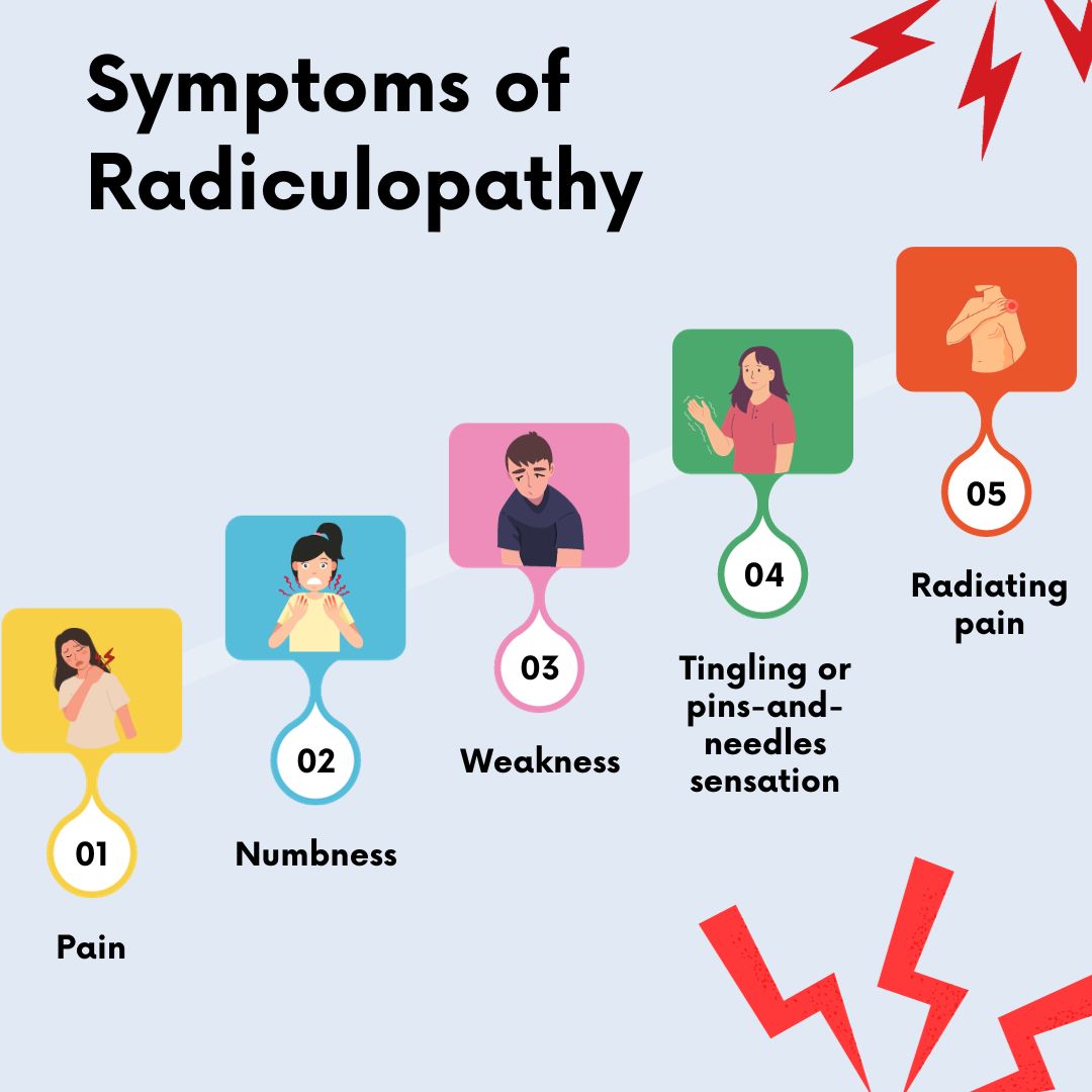 Symptoms of Radiculopathy 