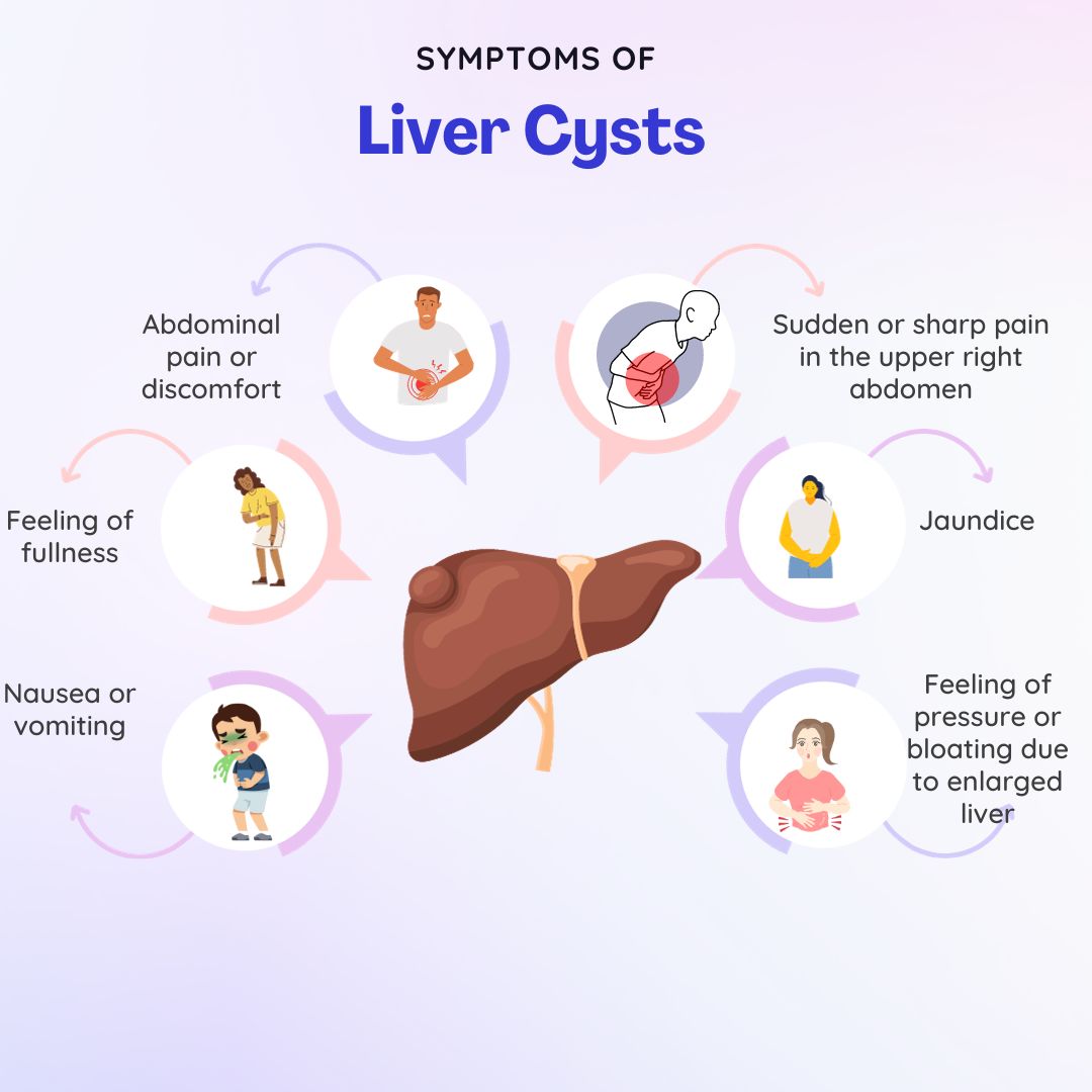 SYMPTOMS OF Liver Cysts 
